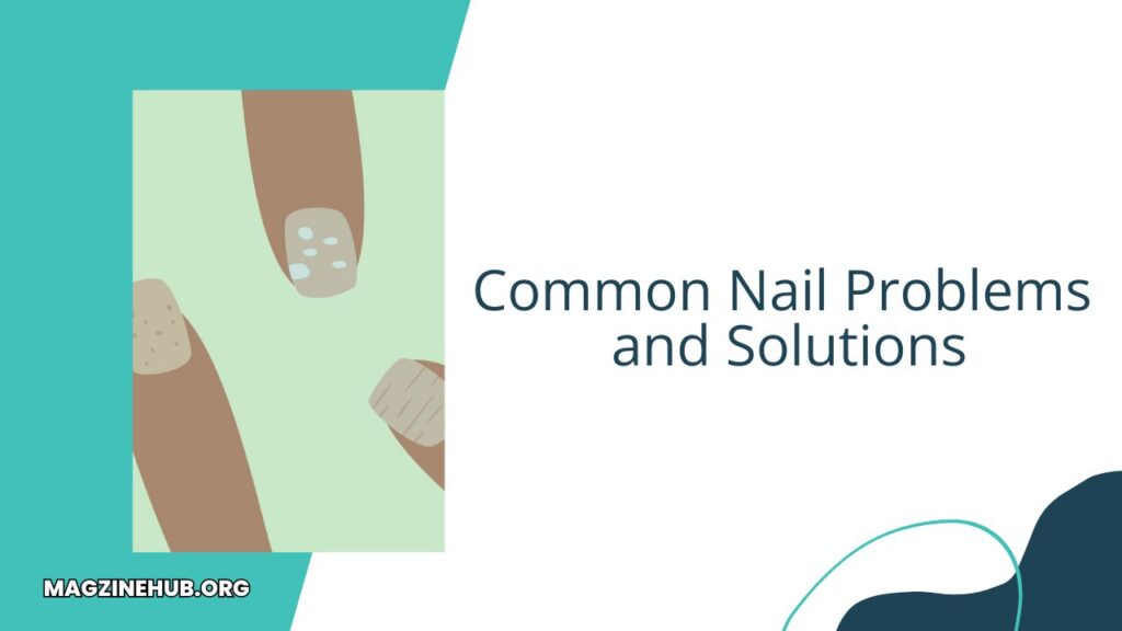 Common Nail Problems and Solutions